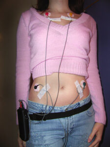 181680613_d1d6f8f1b8_electrodes