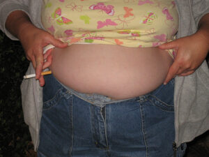 363014979_5e62e9581c